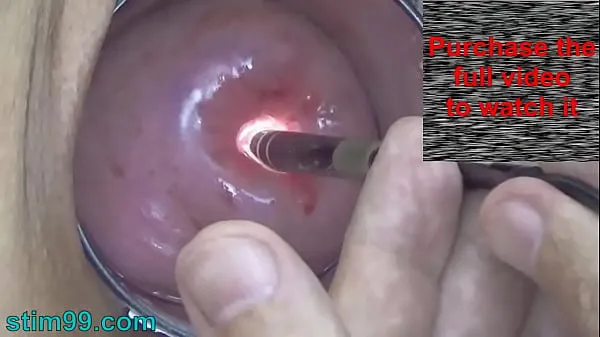 Big Endoscope Camera inside Cervix Cam into Pussy Uterus best Clips